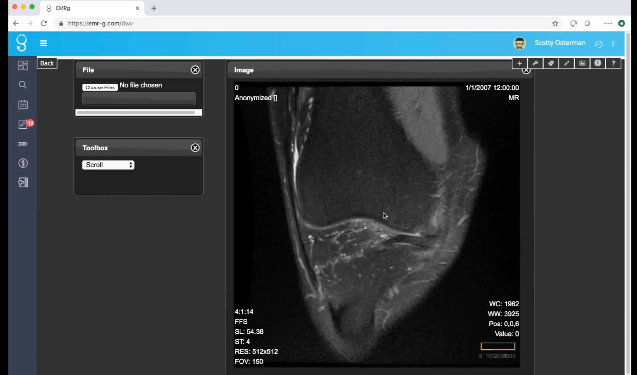 EMRg DICOM viewer rendering an anonymized sample MR imaging study